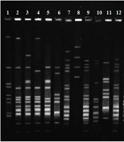 Jundishapur J Microbiol